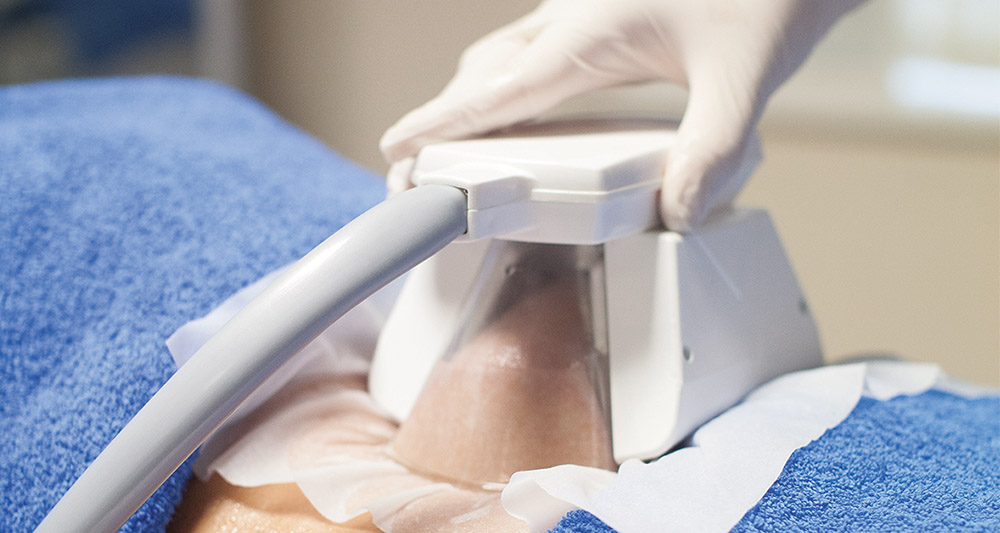 How Fat Freezing and HIFU Work Together? 2 Multiple Areas in One Session HIFU and Fat Freezing Cheshire