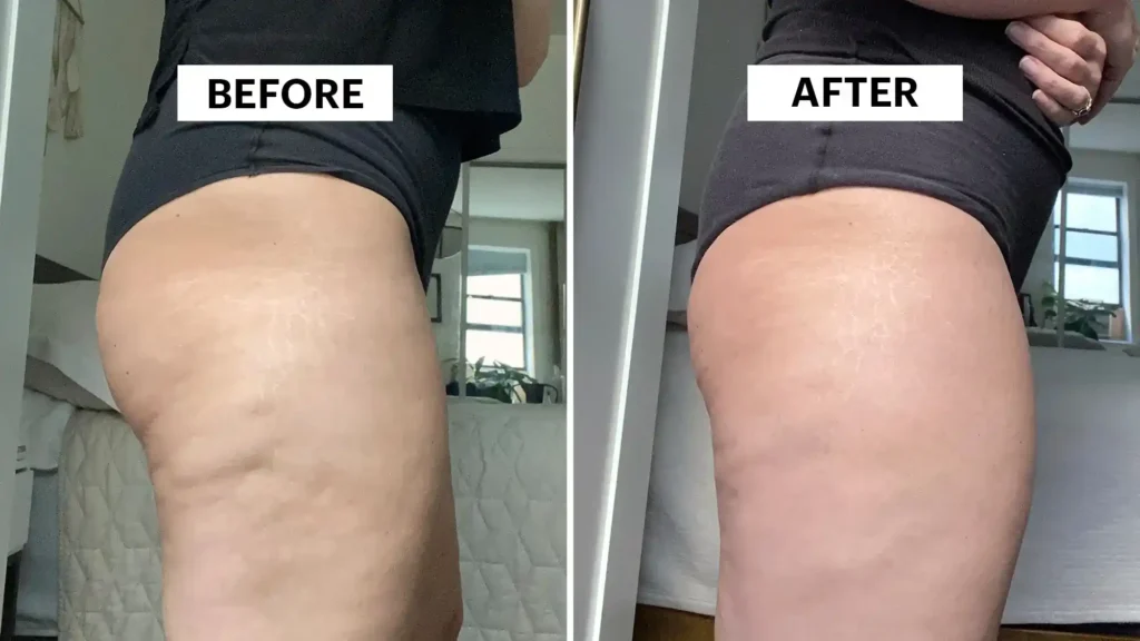 Do Toning Exercise Cheshire Really Tackle Cellulite?