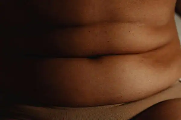 The Hidden Connection: How Stress Shapes Your Fitness and Body Composition 3 image of what stress can do on the stomach area and how Lipo 360 Cheshire can help to change your body shape.