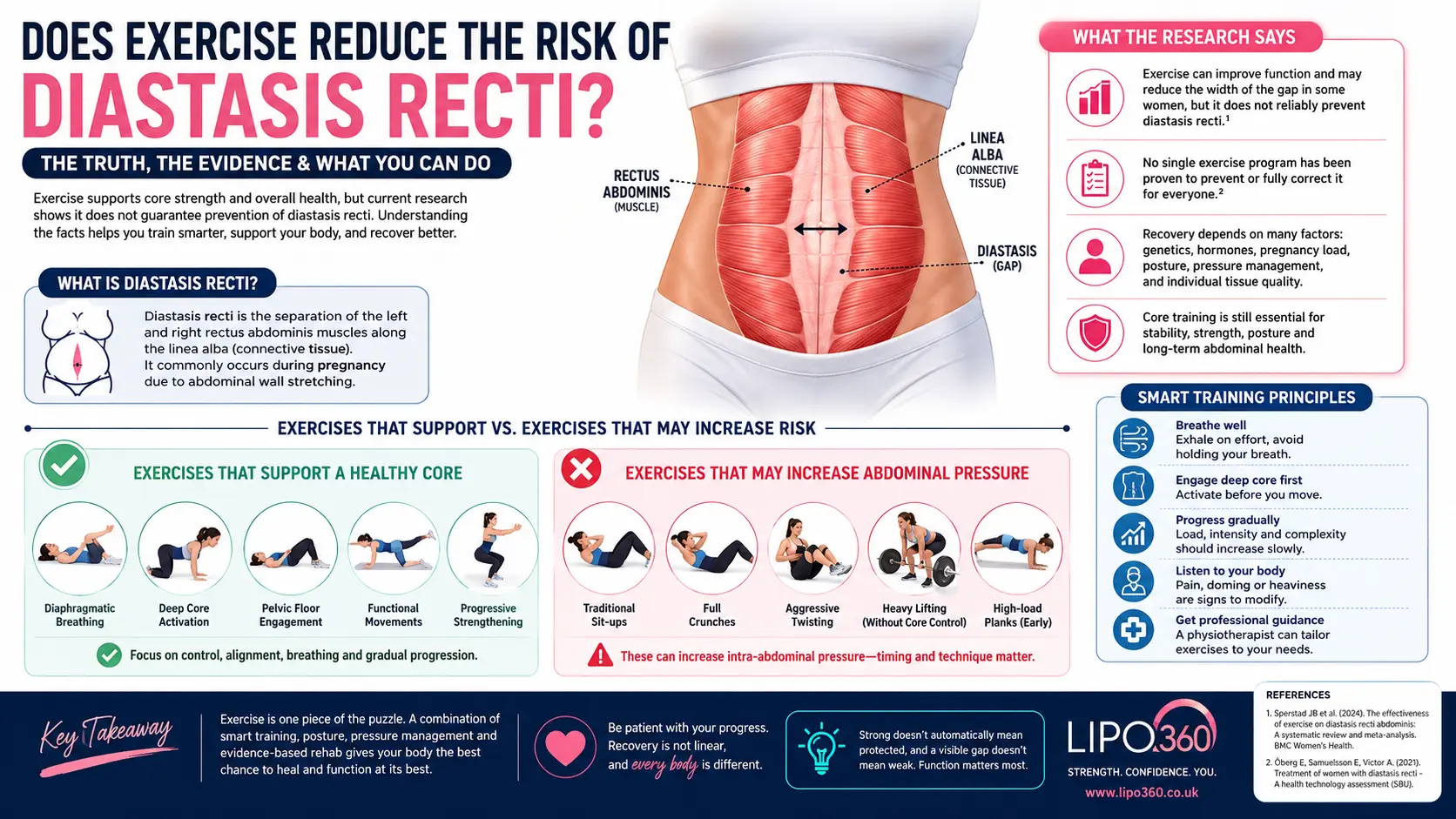 Does Exercise Reduce the Risk of Diastasis Recti? 2 Does exercise reduce the risk of the diastasis recti